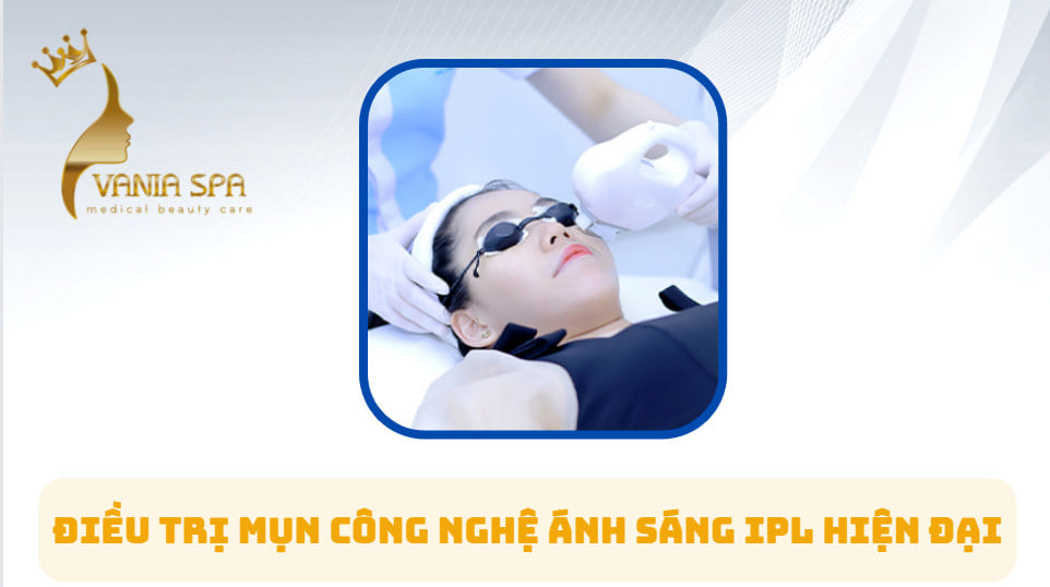 TRỊ MỤN CÔNG NGHỆ CAO TẠI VANIA SPA